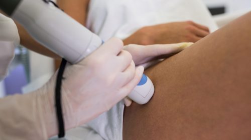 Woman receiving laser epilation treatment on her thigh at beauty salon